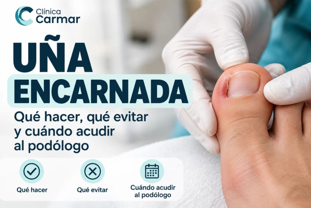 Primer plano de una uña encarnada con el título informativo de Clínica Carmar